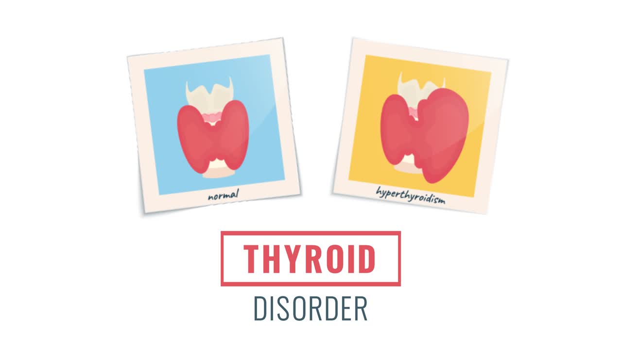 animación de las glándulas tiroideas hipertiroideas y sanas