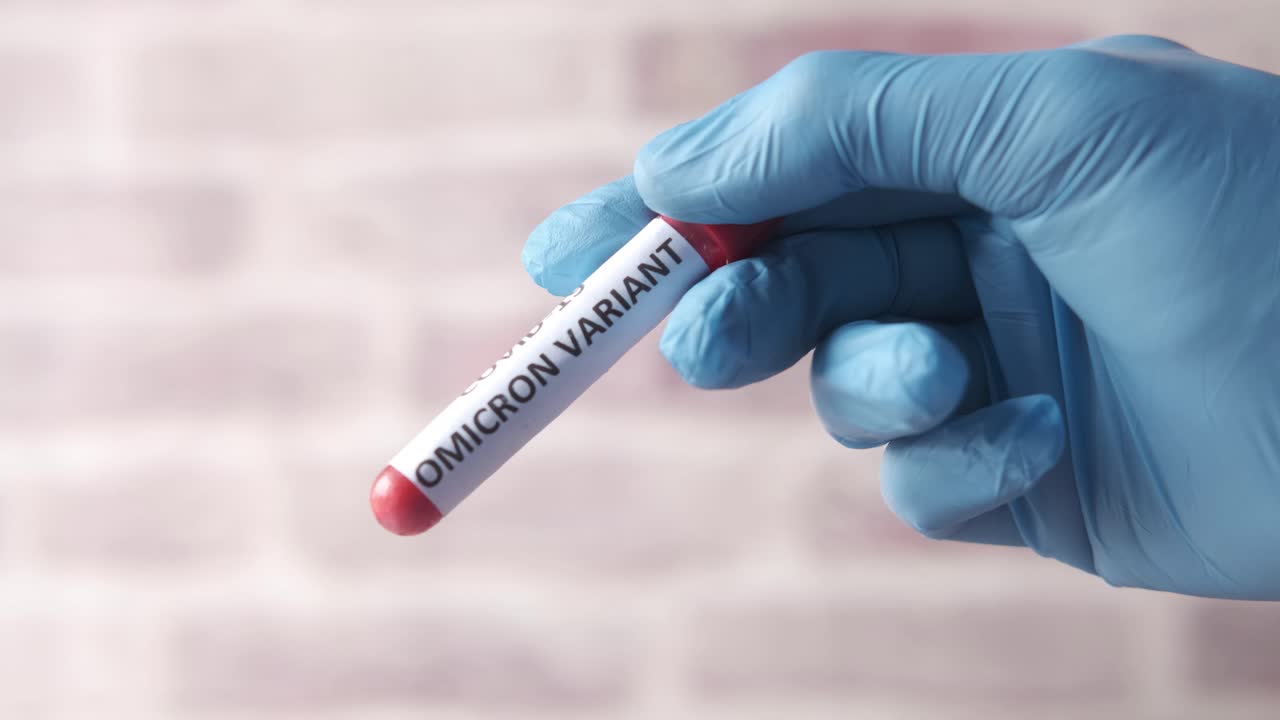 muestra de prueba de la variante omicron de covid-19