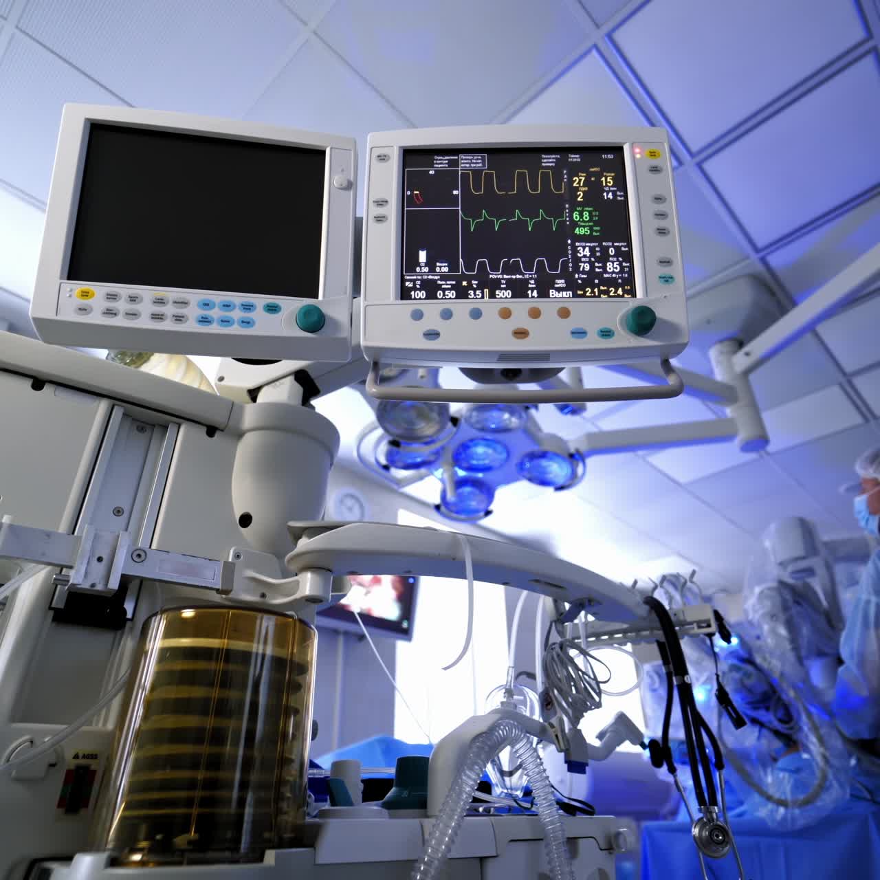 Work of medical equipment in surgical room. Medical monitors and pulmoflator during operation in surgical room. Surgical equipment in hospital.