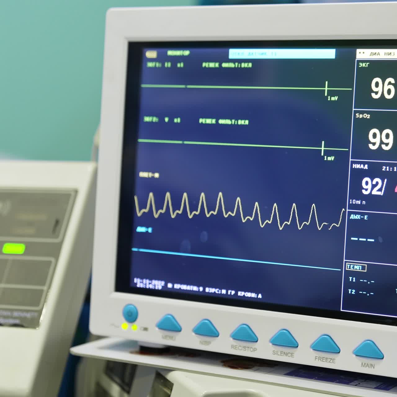 Heart rate, pulse and oxygen level parameters on the monitor checking the life signs of the patient. Close up. Medical equipment in modern hospital