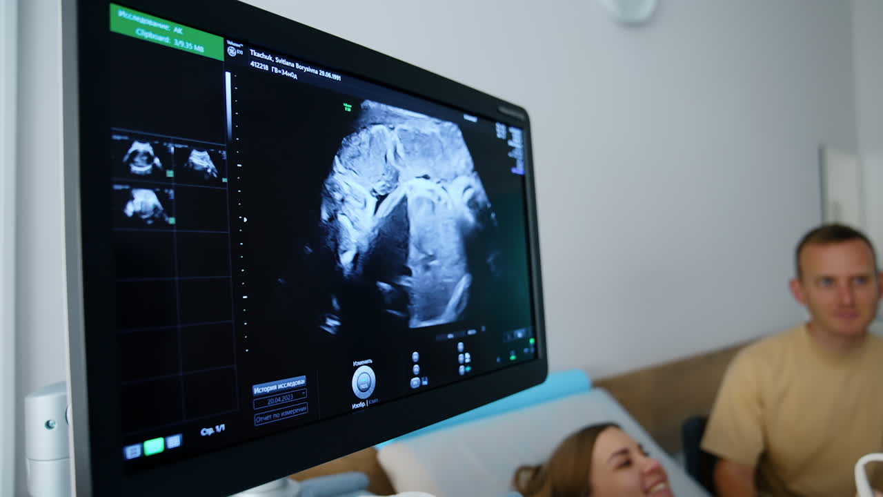 Ultrasound scan on the screen of the medical equipment. Caucasian couple having pregnancy check up.