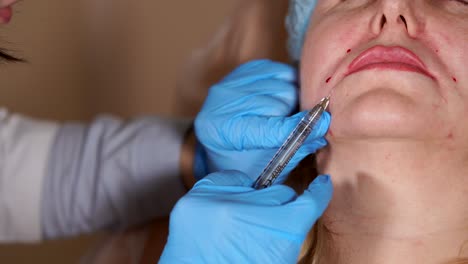 procedimiento de inyección facial