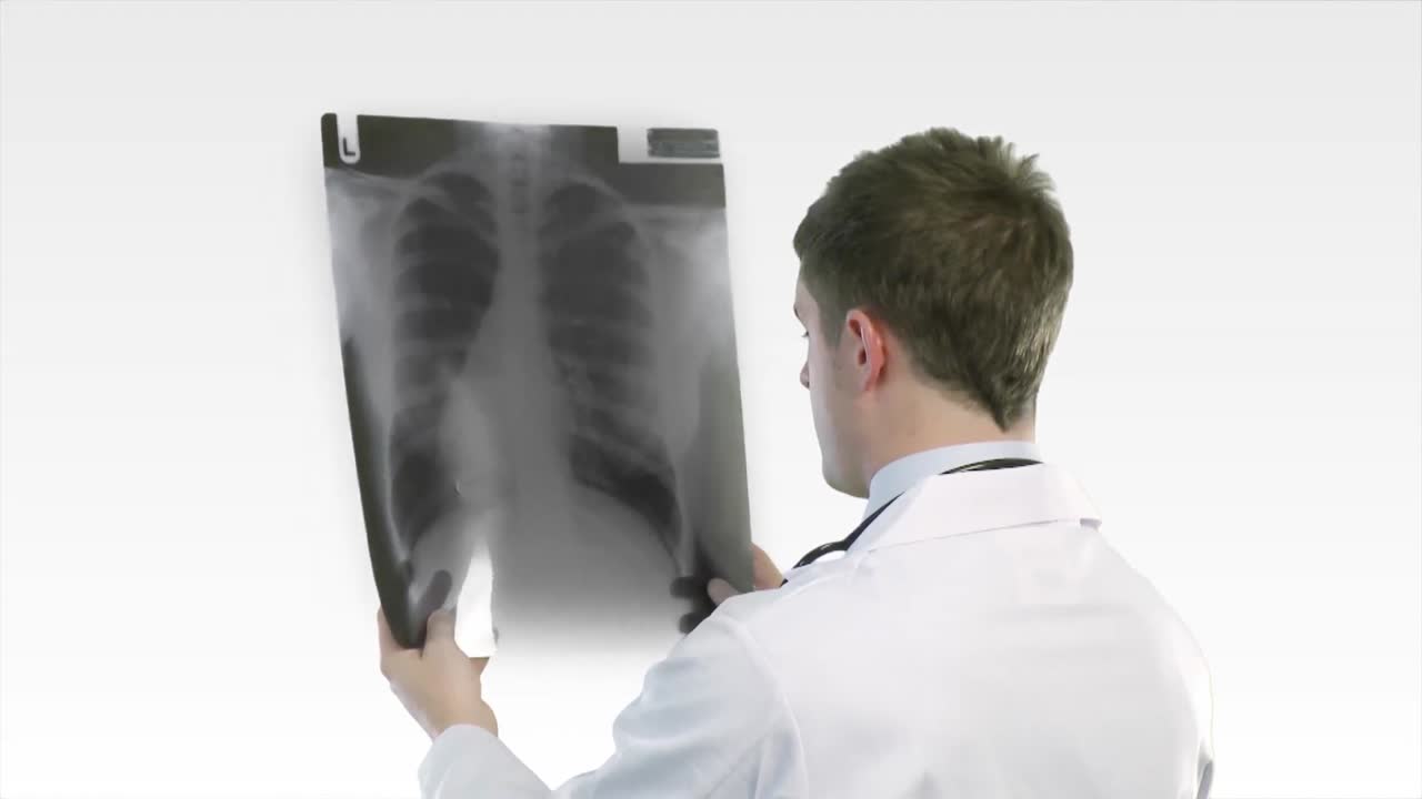 Doctor looking at an xray