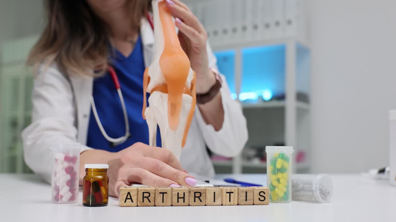 Médico Explicando Anatomia da Articulação do Joelho e Artrite com Modelo