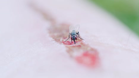 una mosca sentada en la cicatriz de una herida en la pierna humana bebiendo sangre