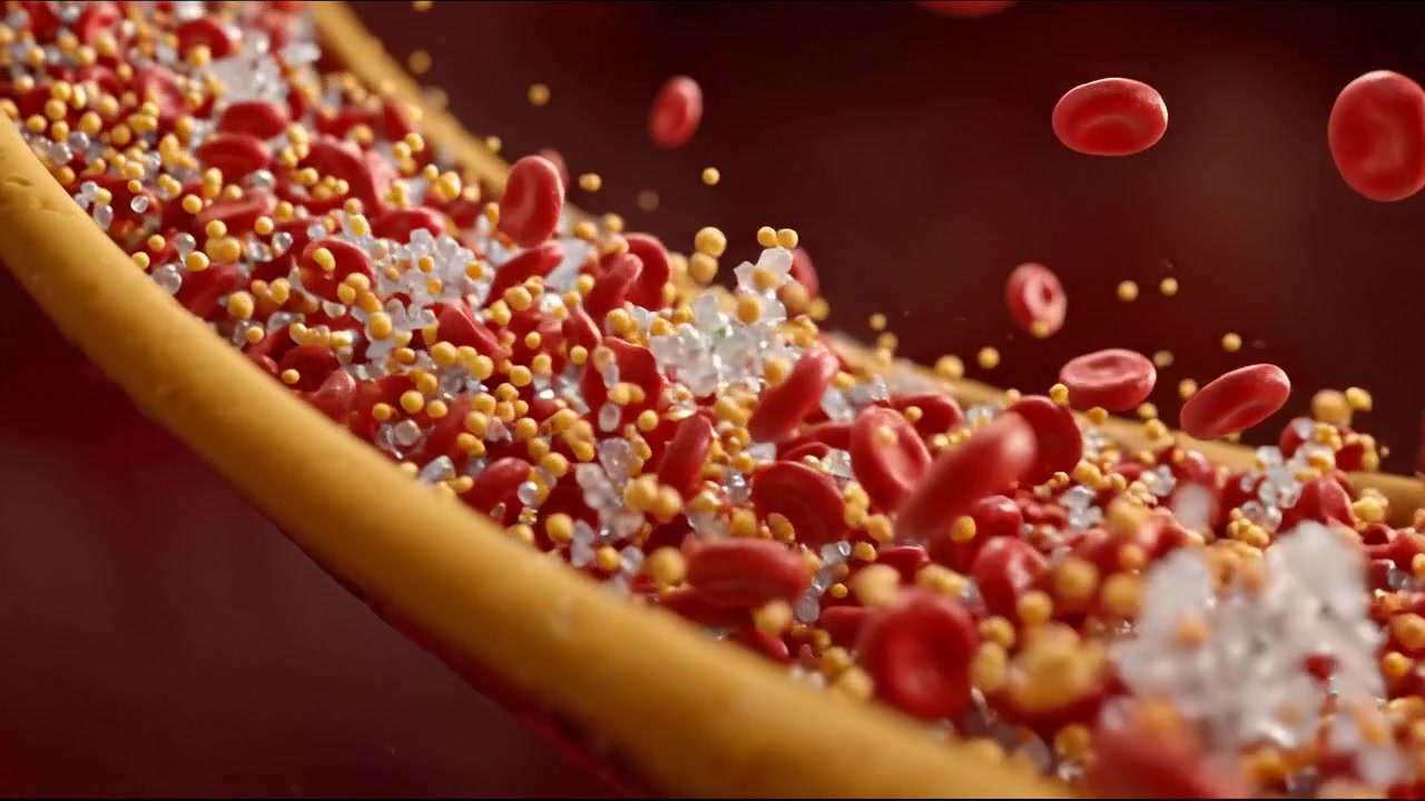 Red Blood Cells and Particles Flowing Through a Detailed Artery Interior