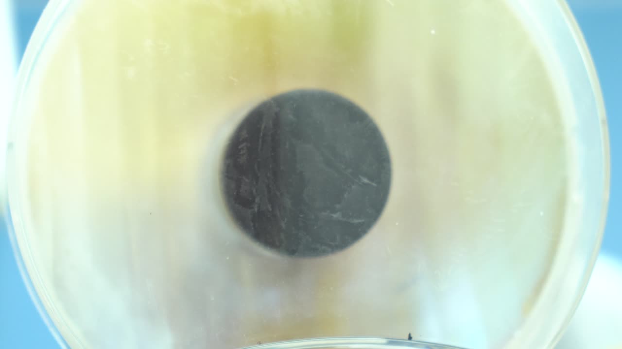 placa de petri con muestra