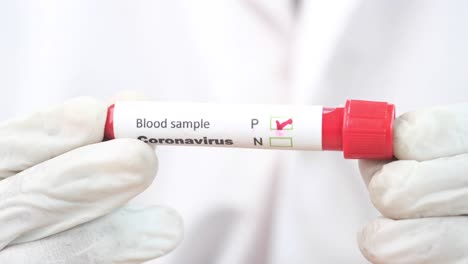 coronavirus blood sample test