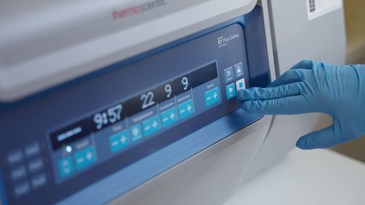 실험실에서 혈액 샘플 기계를 사용하여