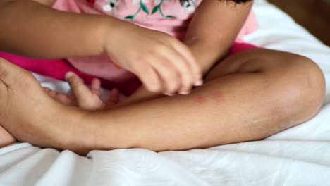 child girl suffering from itching skin, close up