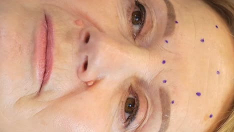 woman preparing for facial rejuvenation treatment