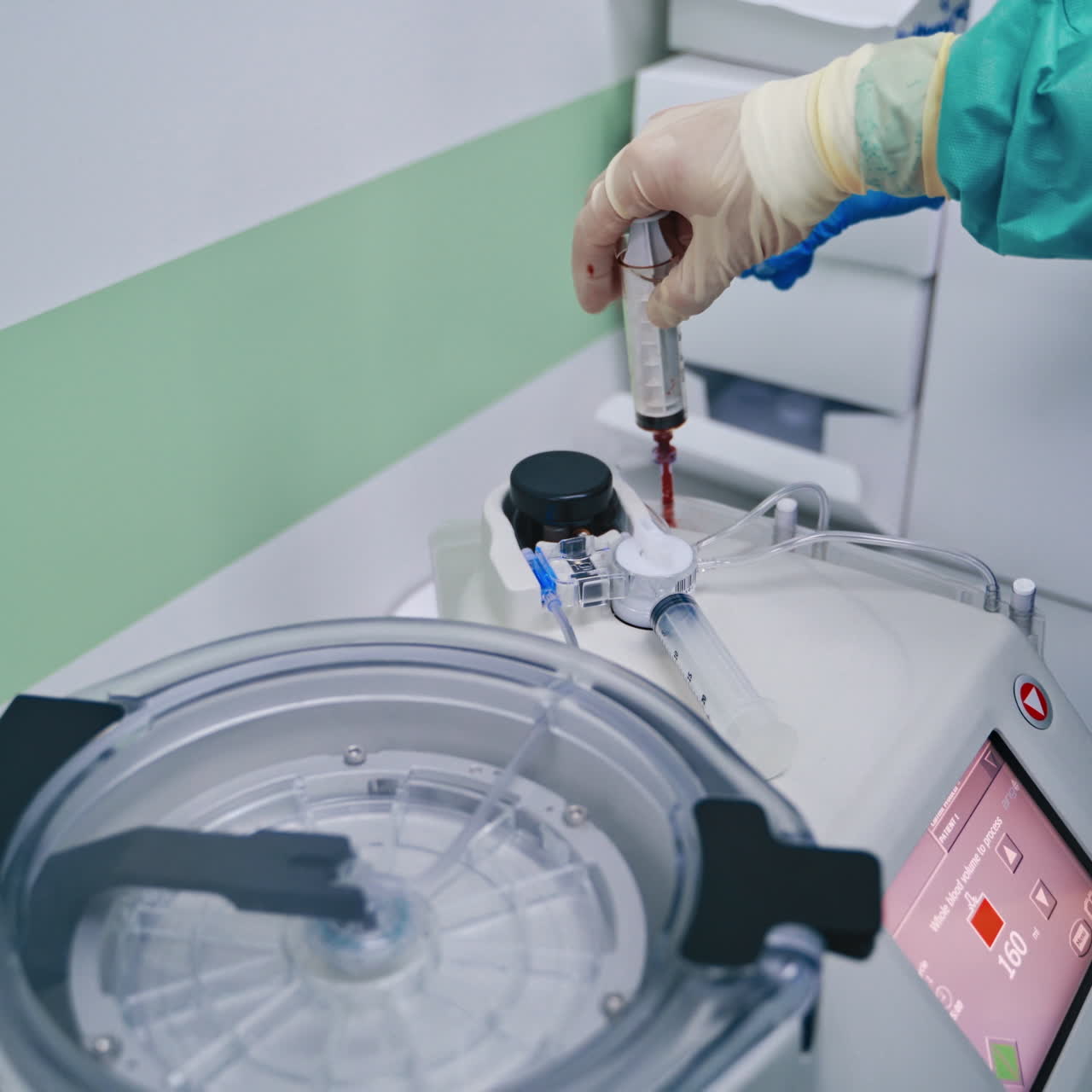 Stem cell therapy. Plasma in syringe. Centrifuge.