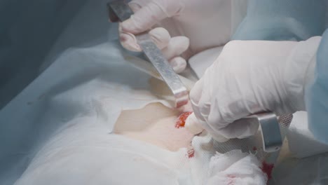 surgical procedure