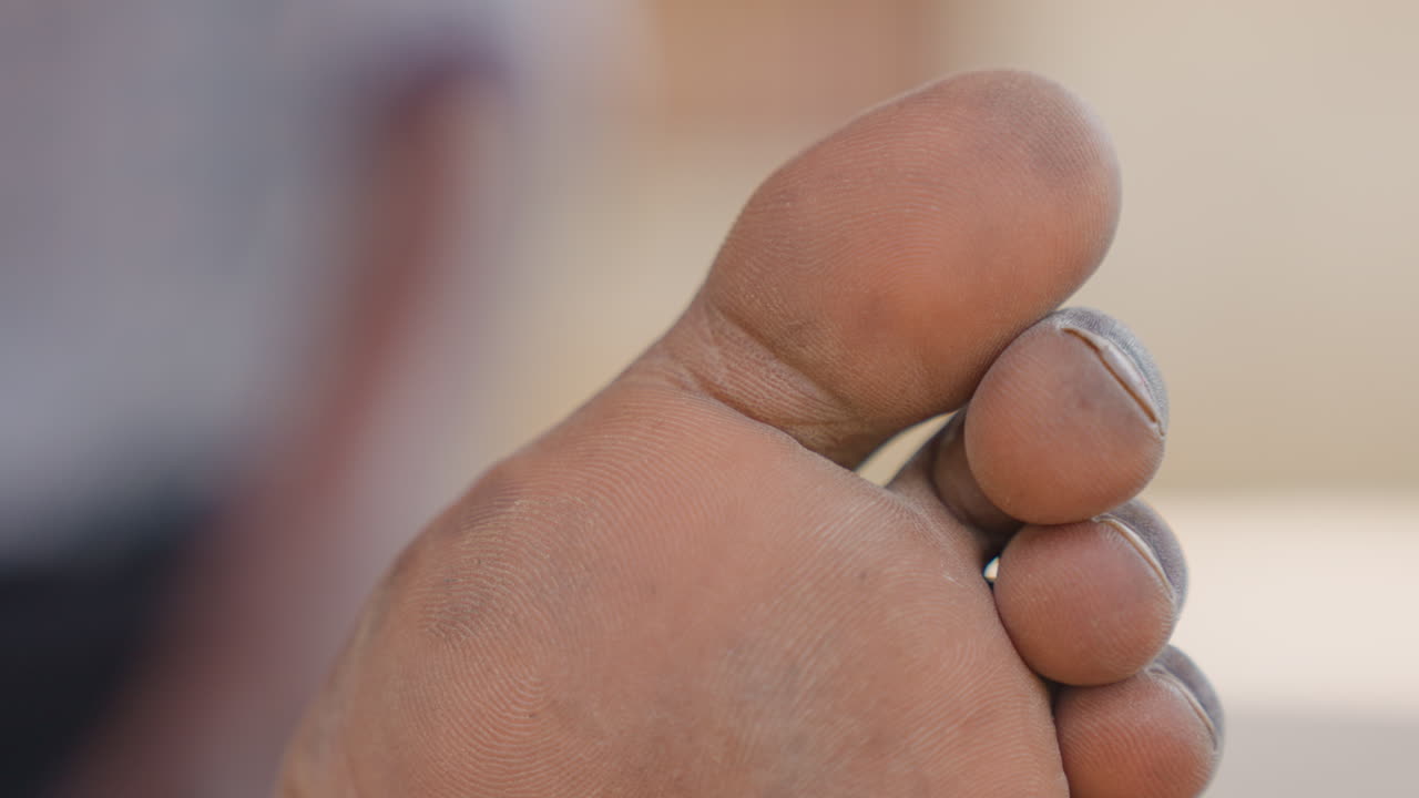 Primo piano di dita dei piedi scure che mostrano calli e texture sulla pianta, sottili granelli di sporco, ispezione focalizzata dei cuscinetti delle dita e delle unghie, studio macro della presa e della pressione durante l'allenamento, dettaglio atletico intimo.