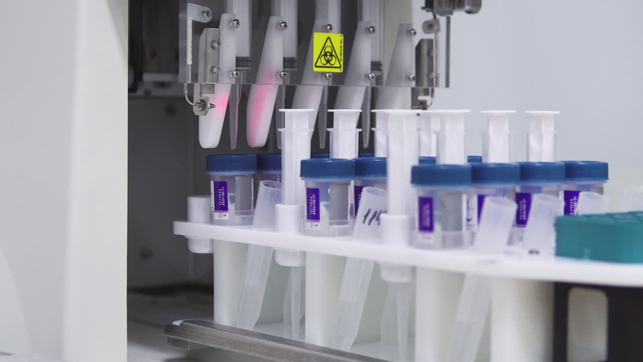 Close-up in the medical laboratory, the robot pierces a jar of liquid with a needle and pours it into a tube for further analysis by the doctor