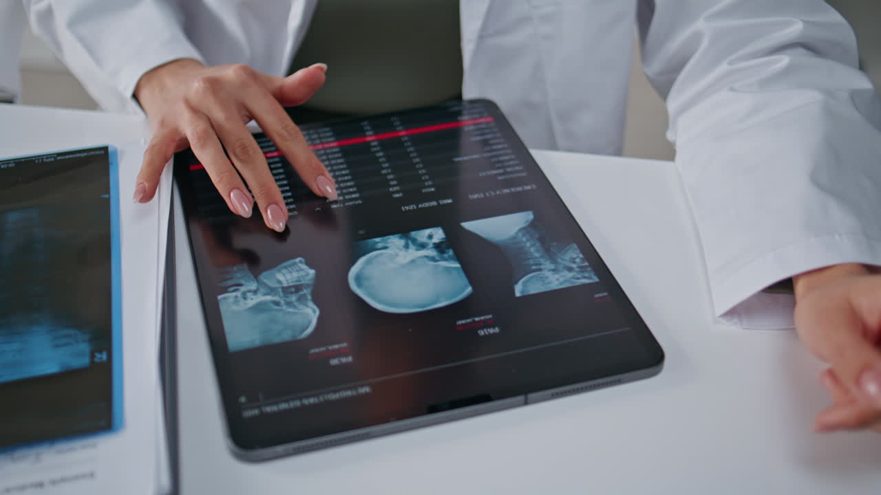 Doctor examining skull x-ray on tablet at hospital closeup. Physician hands