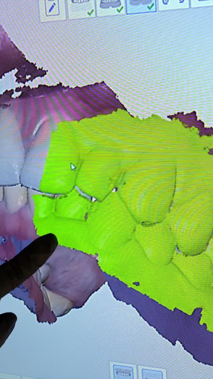 3D dental scan of teeth