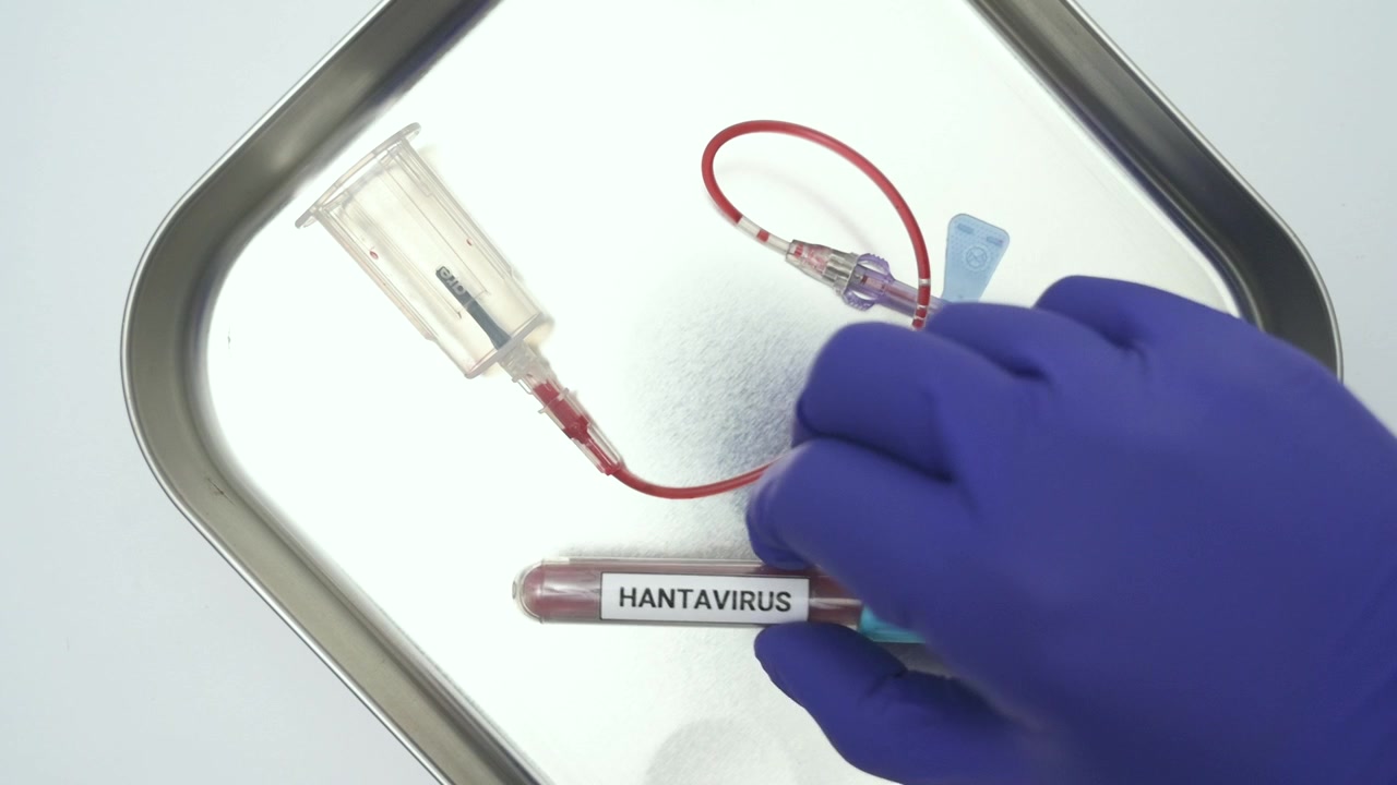Doctor analyzing a hantavirus blood sample in a laboratory, isolated on a white background