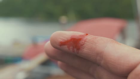 close up of minor cut bleeding on young man's finger