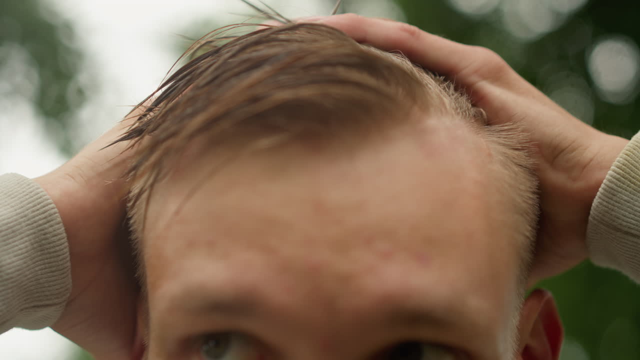 젖은 머리카락, 비 오는 공원, 백인 남성, 클로즈업으로 머리카락과 두피를 걱정스러운 표정으로 확인, 이마에 맺힌 물방울, 캐주얼한 통근 분위기, 초록색 보케 배경, 라이프스타일 및 튜토리얼