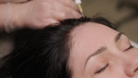 a focused treatment of mesotherapy on the scalp to enhance hair vitality, showcasing the precision and care of the medical practitioner