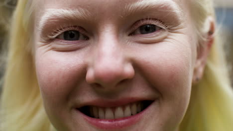 Closeup-albino-woman's-face