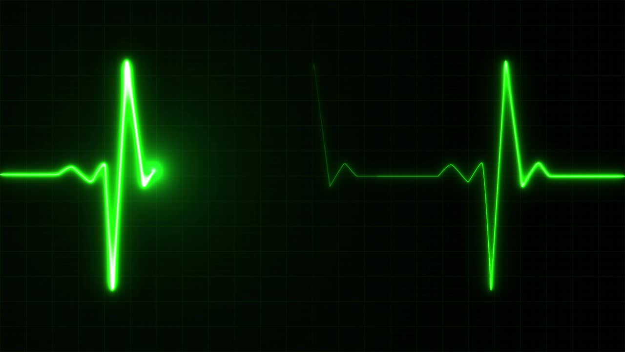 Heartbeat ECG Monitor