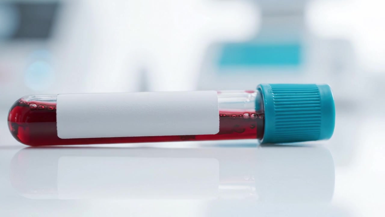 Close-up View of a Blood Sample in a Test Tube with a Turquoise Cap on a Laboratory Table for Medical Analysis and Research Purposes