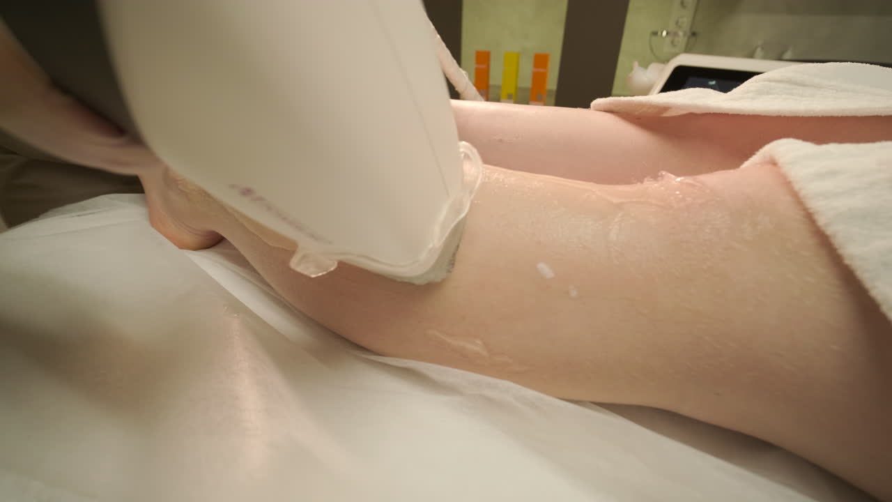 Woman Receiving Laser Hair Removal Treatment on Leg in Clinic