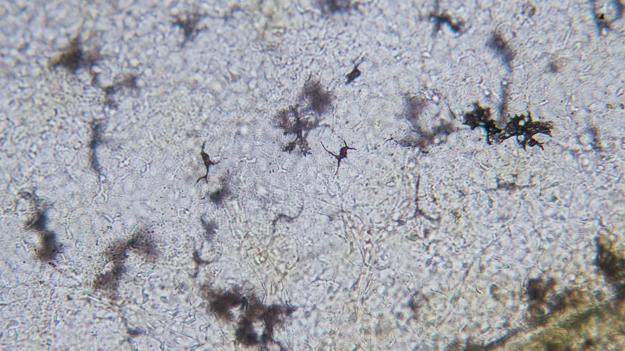 혈관 모세관 현미경의 혈액 적혈구 이동