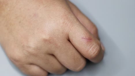 curación secuencial de un corte en un dedo