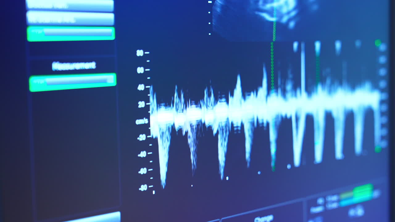 Blue screen at ultrasound diagnostic equipment. White curve moving quickly on the monitor and the shot of a baby inside mom's belly.