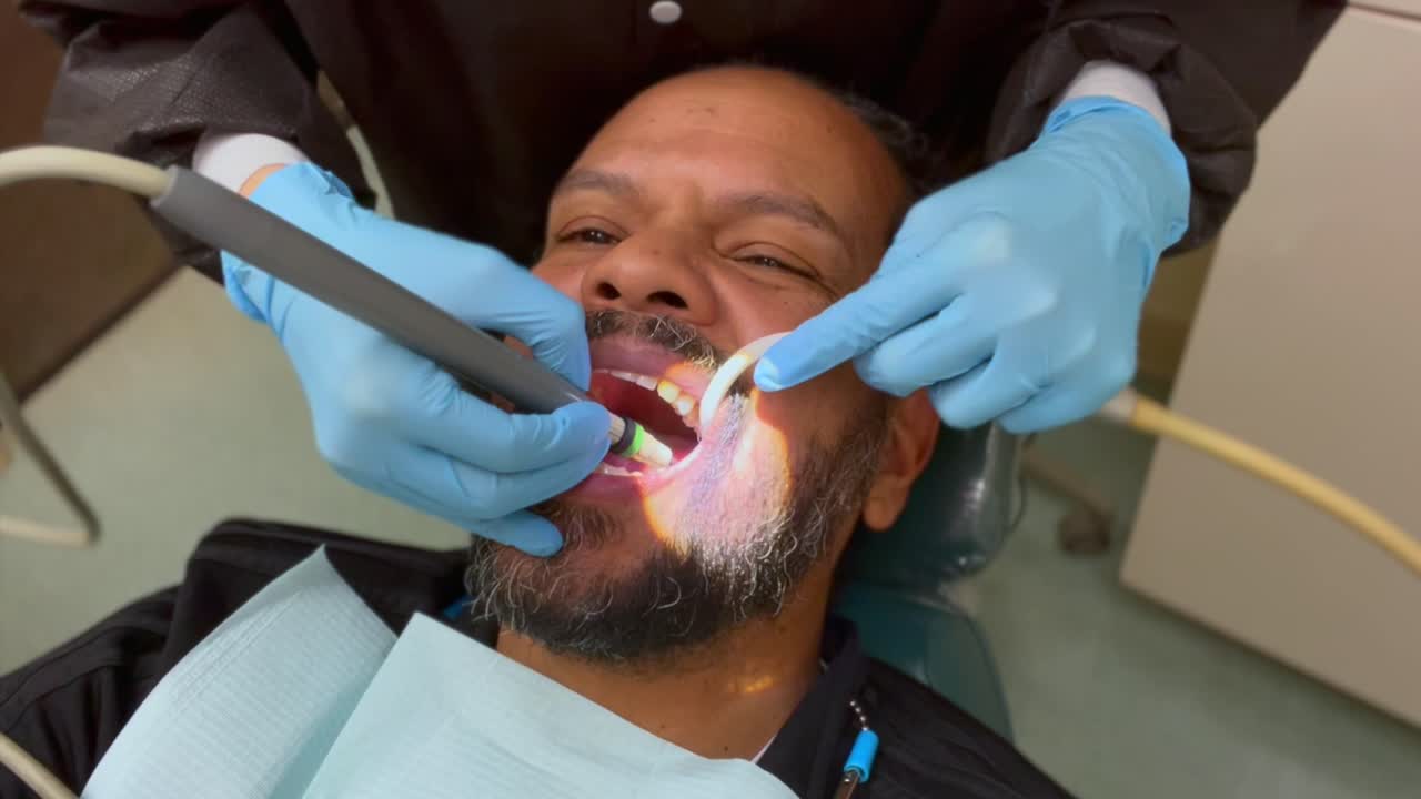 A close-up view of a middle aged man of mixed races with a beard at the dentist, getting his teeth cleaned by a dental hygienist