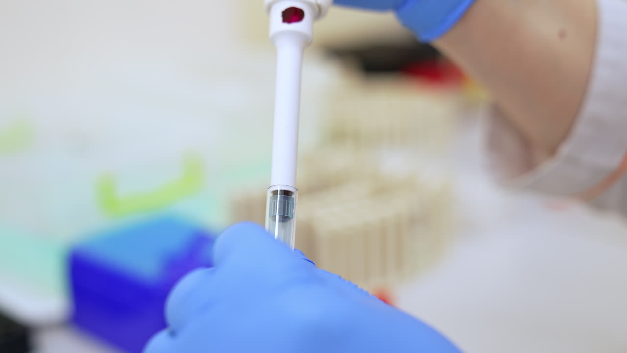 Device pipette taking in the yellow liquid. Close up. Female laboratory assistant in blue latex gloves working in the hospital.