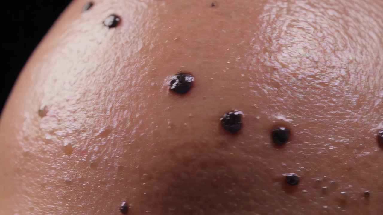 Close-up of human skin with moles and sweat