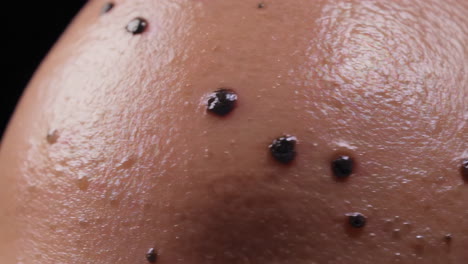 close-up of human skin with moles and sweat