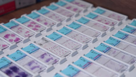 Laboratory of test blood. Rack of test samples in medical laboratory