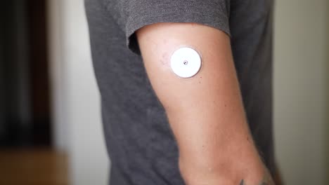un primer plano del brazo de un joven con diabetes controla sus niveles de glucosa en sangre en su casa con su teléfono inteligente y un sensor de lectura de glucosa en su brazo.
