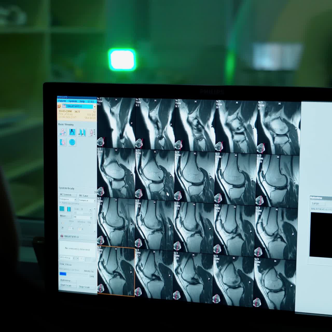 Computer Screen Showing MRI