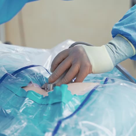 ultrasound machine and ultrasonography in surgery. medical equipment, healthcare concept. selective focus of process. video