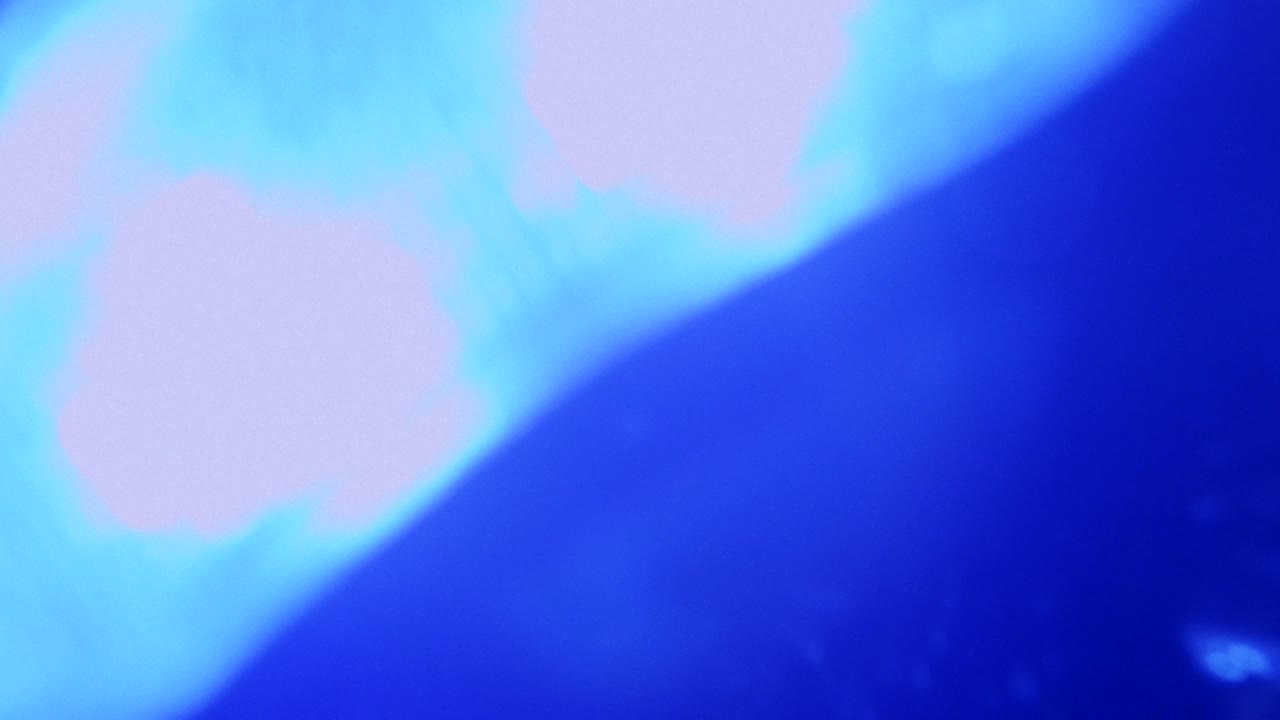 las fugas de luz del elemento 462