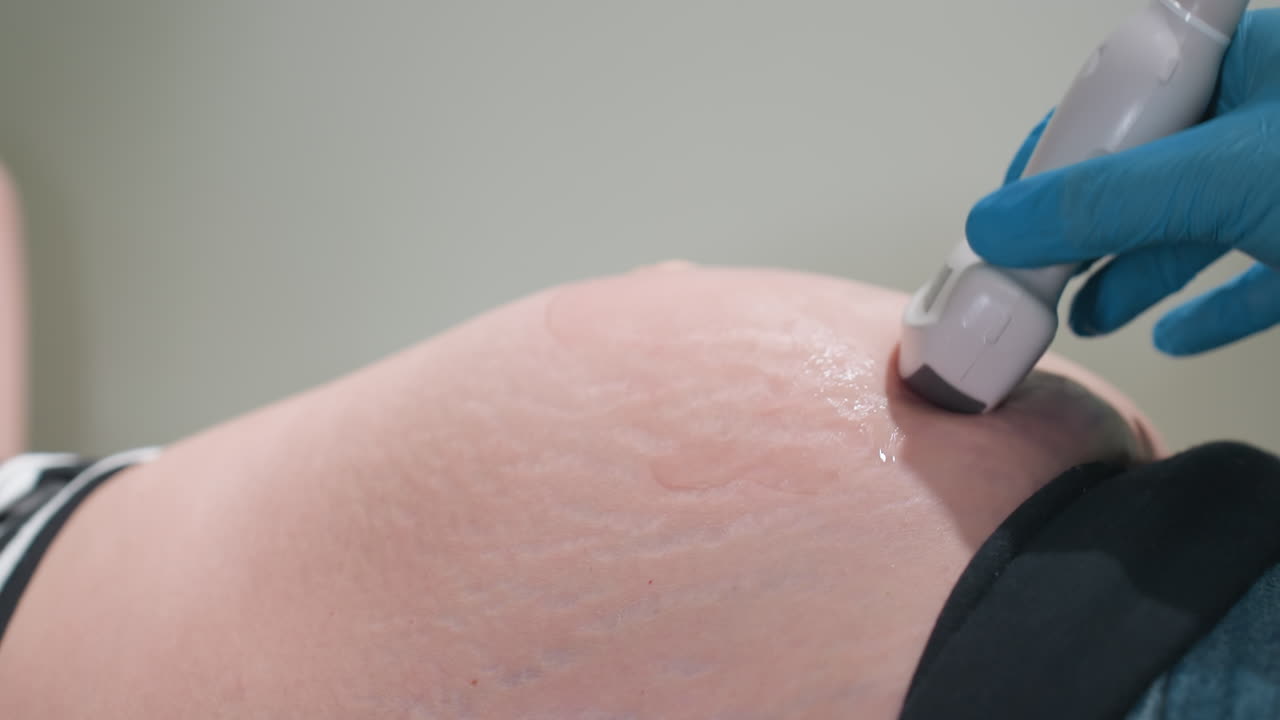 fluttering movement visible on belly of pregnant woman as laboratory scientist gently examines with ultrasound transducer during prenatal session showcasing early signs of fetal activity