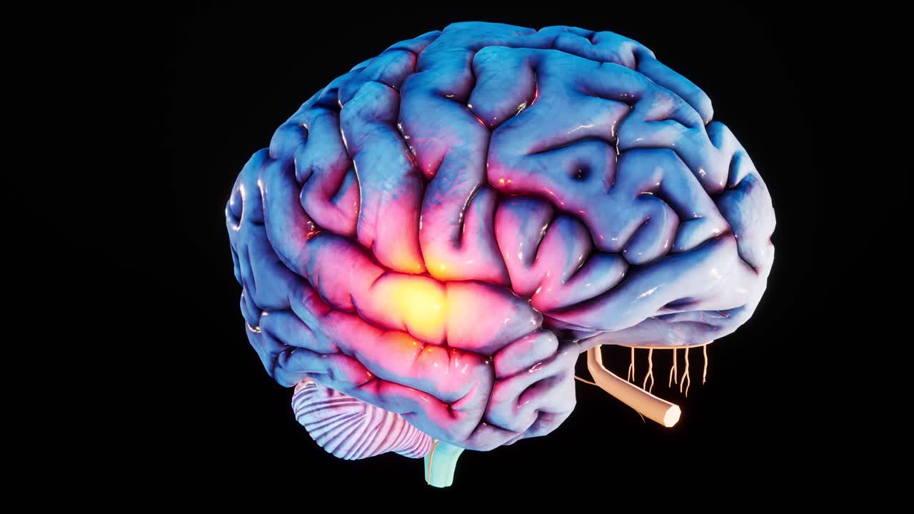 inflamación del cerebro. modelo anatómico del cerebro humano en 3d