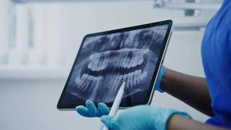 dentist reviewing a panoramic dental x-ray on a tablet