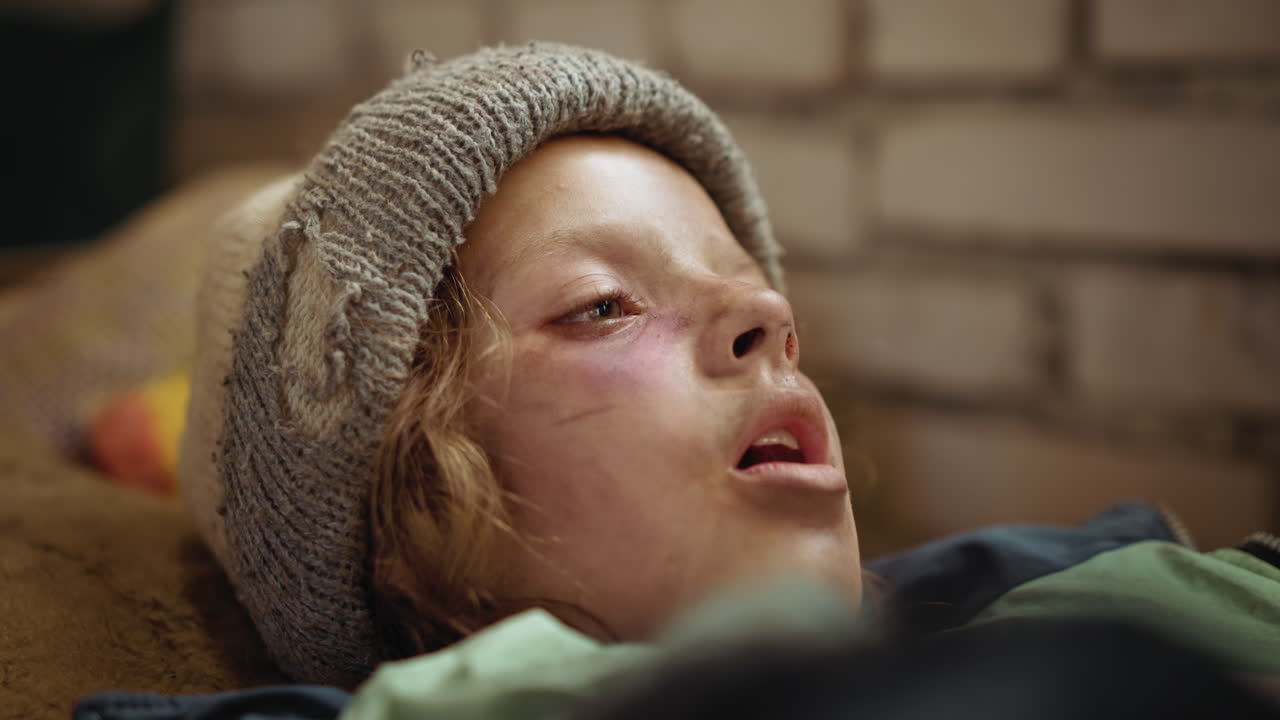 Close up of sick minor with bruised eye and dirt streaked face lying down, lips slightly parted while coughing, wearing torn wool cap and layered clothing