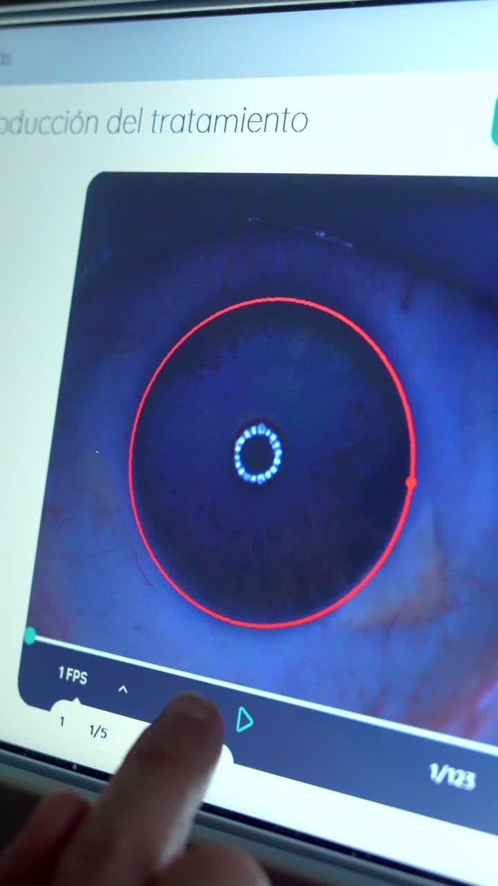 Eye Treatment Diagnostic Imaging