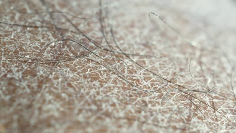 close up of dry skin with flakes and hair