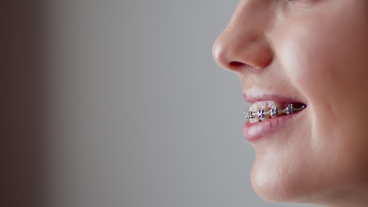 Woman with Braces