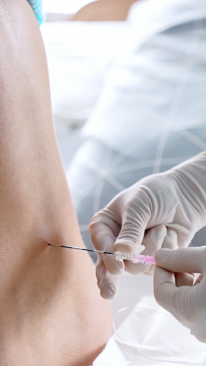 Il medico esegue un'anestesia epidurale su una donna incinta. Preparazione al parto. Video verticale