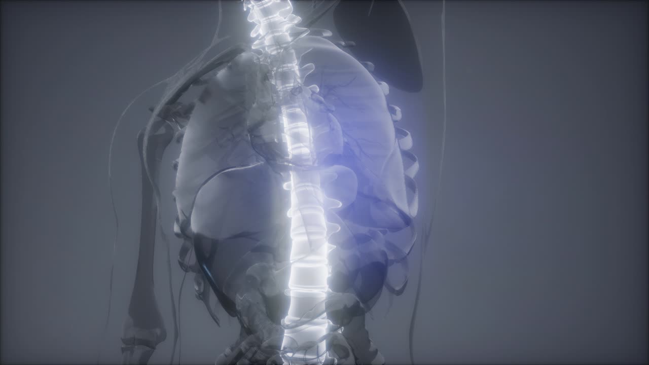 허리  ⁇ 에 허리 통증